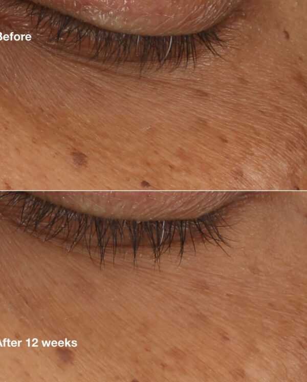 S05129434_1 S05129434_1